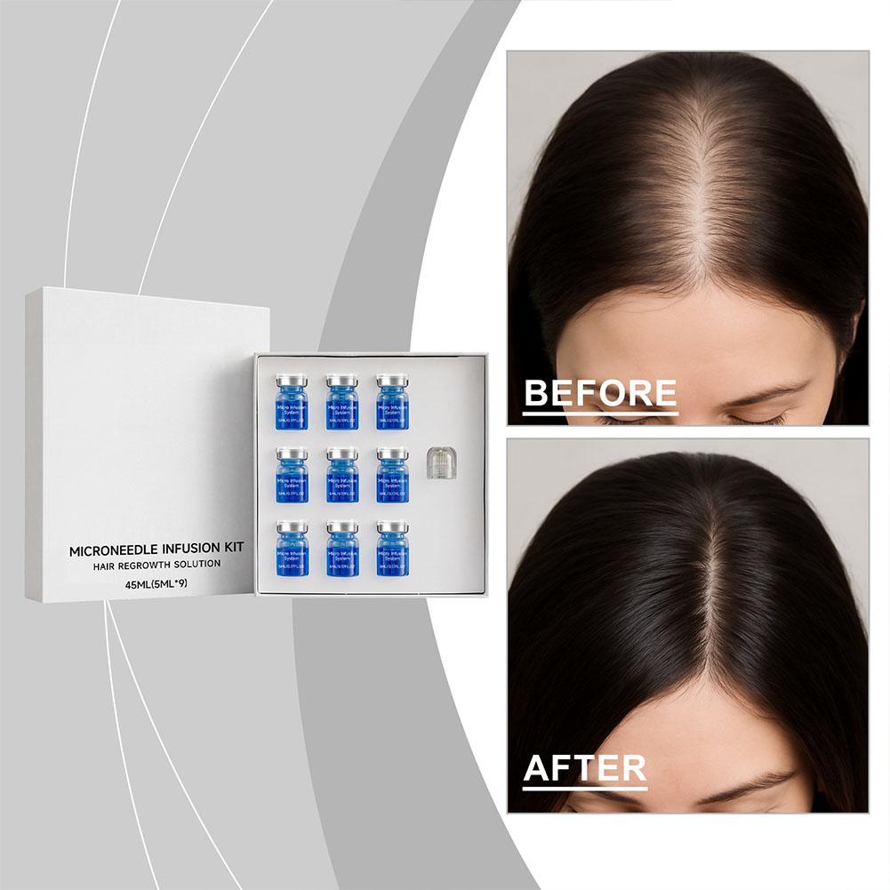 Hair Care Essence Oil - مجموعة أدوات العناية بالشعر: سيروم أساسي