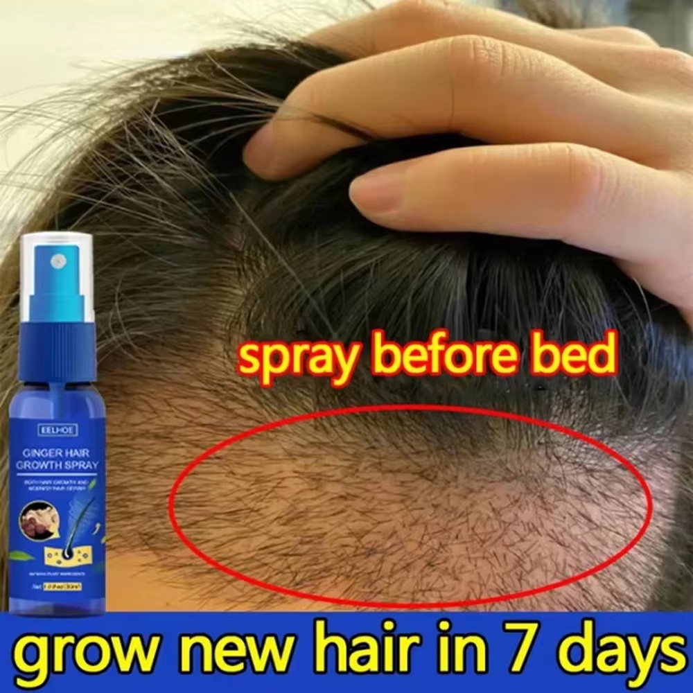 Hair Care Serum - بخاخ الزنجبيل السريع لنمو الشعر، مصل