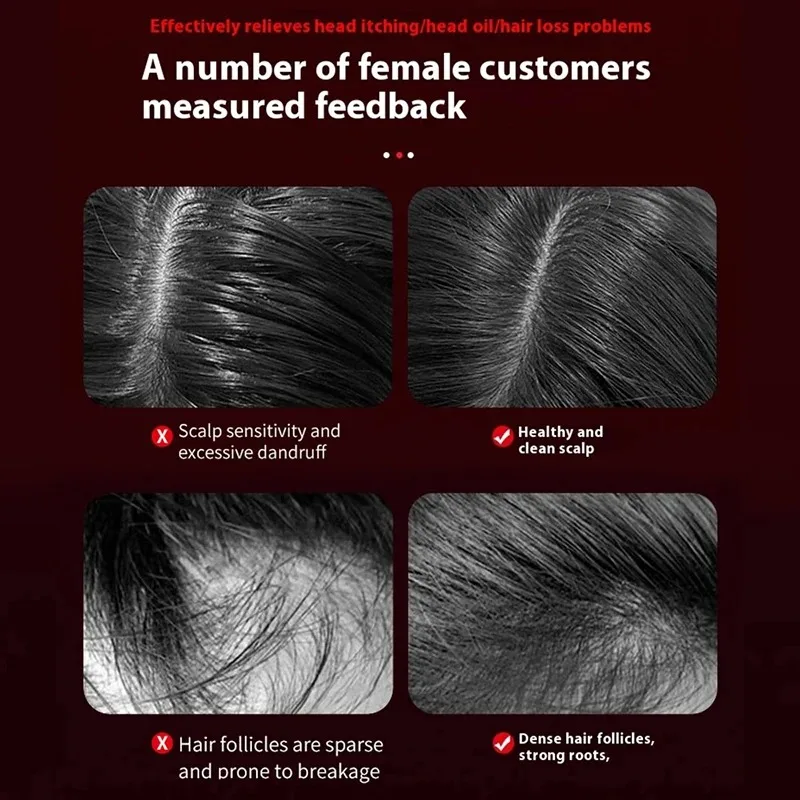 مشط تدليك كهربائي بالاهتزاز لل - مراجعة Hair Care For Hair Loss وسعره