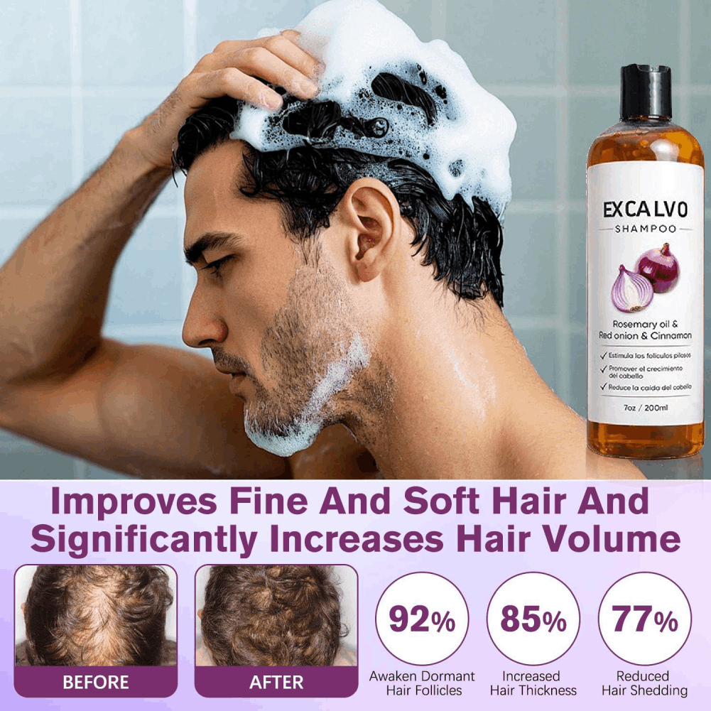 شامبو مضاد لتساقط الشعر بالروز - مراجعة Rosemary Hair Oil وسعره