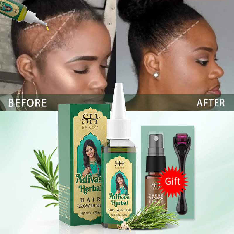 زيت نمو الشعر الأيورفيدي الهند - مراجعة Hair Care Essence Oil وسعره