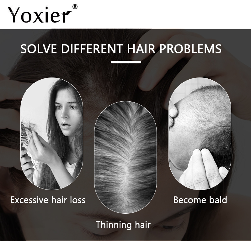سيروم نمو مكثف يمنع تساقط الشع - مراجعة Hair Care Serum وسعره