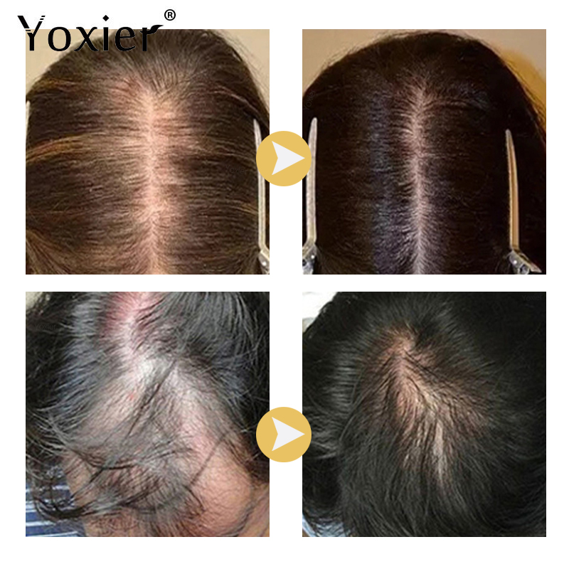 سيروم نمو مكثف يمنع تساقط الشع - مراجعة Hair Care Serum وسعره