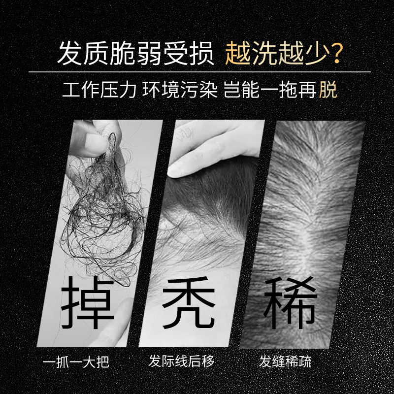 شامبو فامولان المضاد لتساقط ال - مراجعة Hair Care Normal وسعره