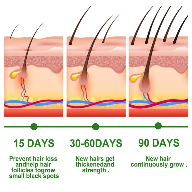 مصل نمو الشعر مجموعة العناية ب - مراجعة Hair Care Essence Oil وسعره