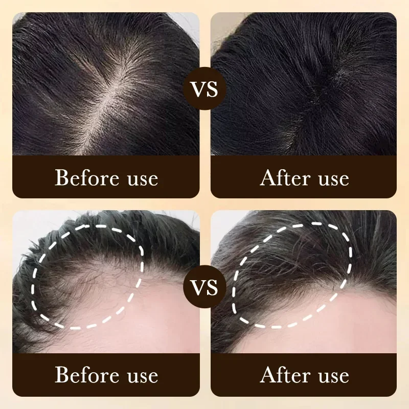 زيت البيوتين لنمو الشعر السريع - مراجعة Hair Care Essence Oil وسعره