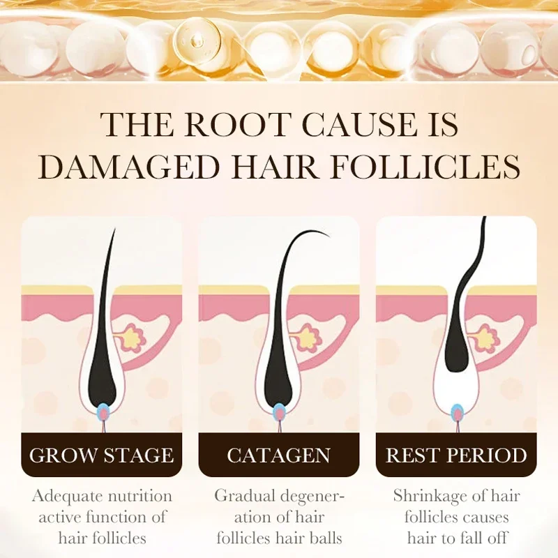 زيت البيوتين لنمو الشعر السريع - مراجعة Hair Care Essence Oil وسعره