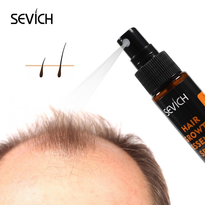 Sevich 30 مللي زيت Hebal جوهر  - مراجعة Hair Care Essence Oil وسعره