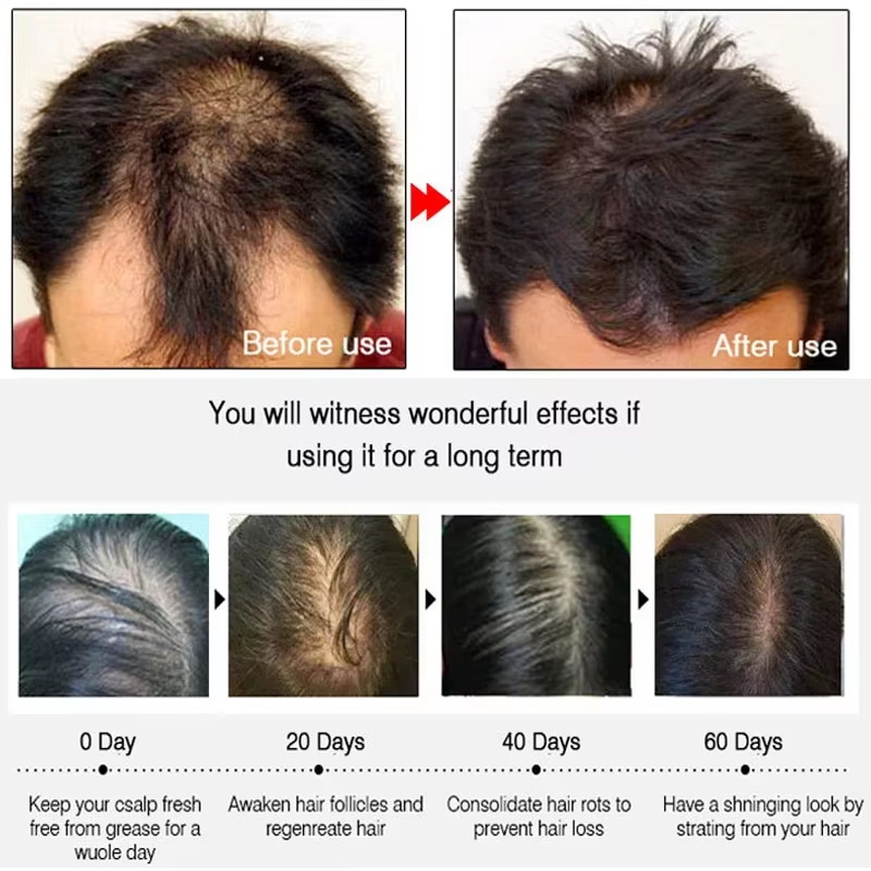 بخاخ الزنجبيل السريع لنمو الشع - مراجعة Hair Care Serum وسعره