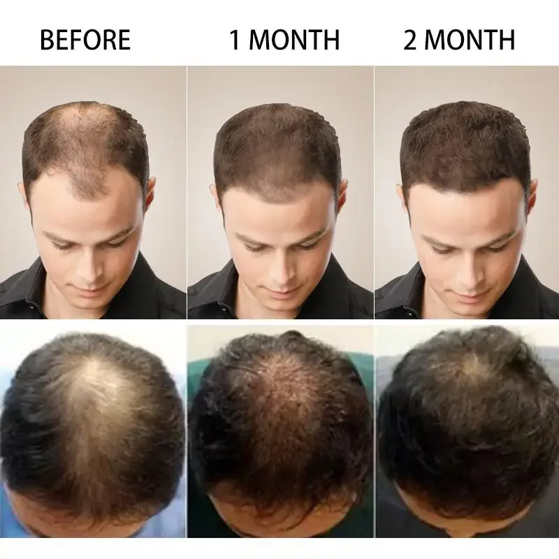 نمو الشعر الزنجبيل سريع النمو  - مراجعة Hair Care Essence Oil وسعره